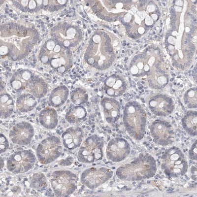 Immunohistochemistry-Paraffin: DKFZp566F084 Antibody [NBP1-87988]