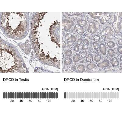 Immunohistochemistry-Paraffin: DKFZp566F084 Antibody [NBP1-87988]