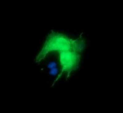 Immunocytochemistry/ Immunofluorescence: DKFZp566F084 Antibody (OTI4B9) - Azide and BSA Free [NBP2-71779]