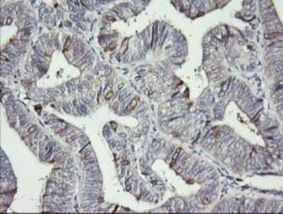Immunohistochemistry: DKFZp566F084 Antibody (OTI4B9) - Azide and BSA Free [NBP2-71779]