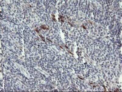 Immunohistochemistry: DKFZp566F084 Antibody (OTI4B9) - Azide and BSA Free [NBP2-71779]
