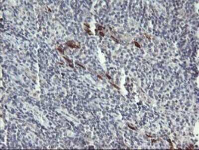 Immunohistochemistry: DKFZp566F084 Antibody (OTI4B9) [NBP2-45679]