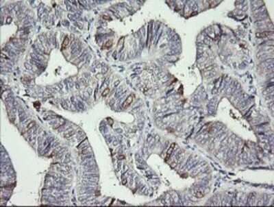Immunohistochemistry: DKFZp566F084 Antibody (OTI4B9) [NBP2-45679]
