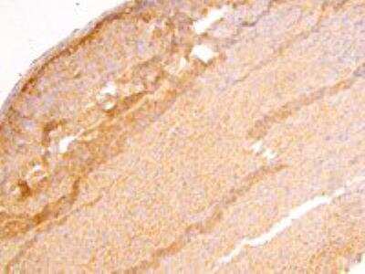 Immunohistochemistry-Paraffin: DLC1 Antibody - Isoform 1 and 3 [NB300-917]