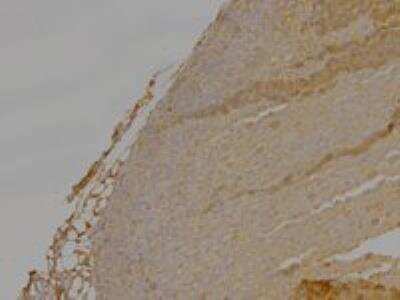 Immunohistochemistry-Paraffin: DLC1 Antibody - Isoform 1 and 3 [NB300-917]