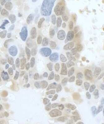Immunohistochemistry-Paraffin: DLG7/HURP Antibody [NB110-40573]