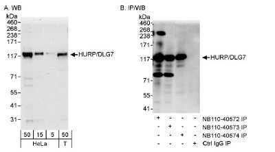 Western Blot: DLG7/HURP Antibody [NB110-40573]