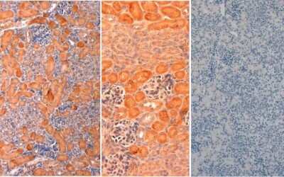 Immunohistochemistry: DLL1 Antibody [NB600-628]