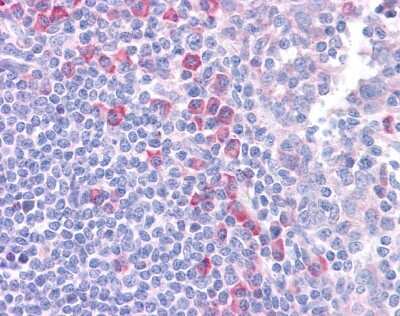 Immunohistochemistry-Paraffin: DLL1 Antibody [NBP1-59217]