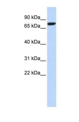 Western Blot: DLL1 Antibody [NBP1-59217]