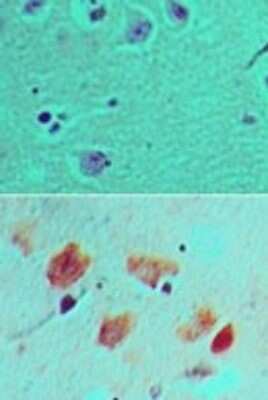 Immunohistochemistry-Paraffin: DLL3 Antibody [NBP2-24669]