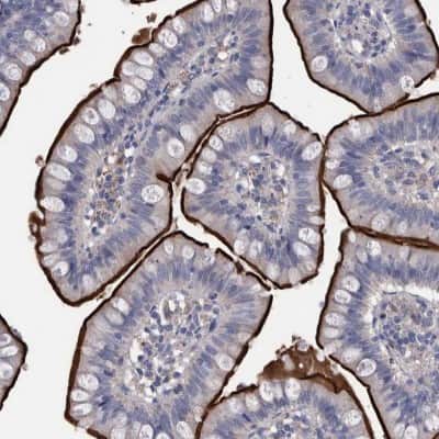 Immunohistochemistry-Paraffin: DLL4 Antibody [NBP1-86413]