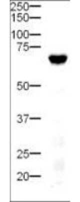 Western Blot: DLL4 Antibody [NB600-892]