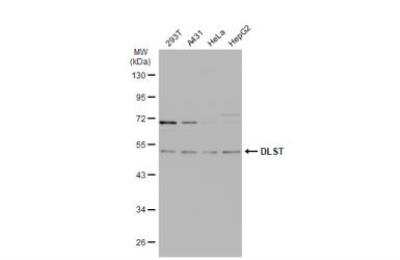 Western Blot: DLST Antibody [NBP1-31715]