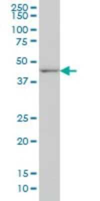Western Blot: DLX2 Antibody (2B12) [H00001746-M04]