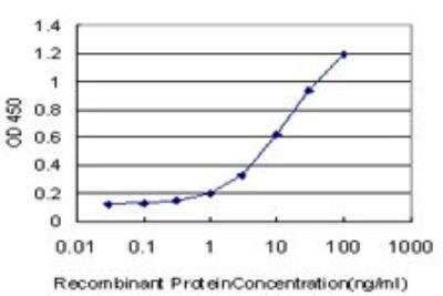ELISA: DLX3 Antibody (3B8) [H00001747-M02]