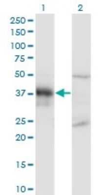Western Blot: DLX3 Antibody (3B8) [H00001747-M02]