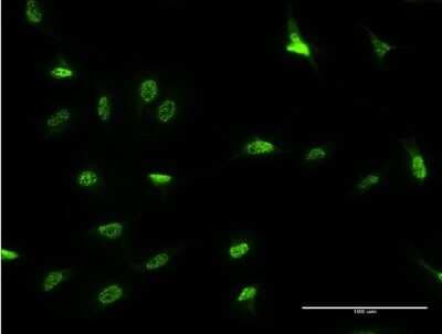 Immunocytochemistry/ Immunofluorescence: DLX3 Antibody (3F7) [H00001747-M09]