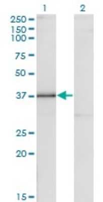 Western Blot: DLX3 Antibody (3F7) [H00001747-M09]
