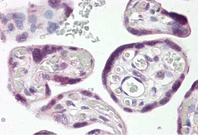 Immunohistochemistry: DLX3 Antibody [NBP2-88802]