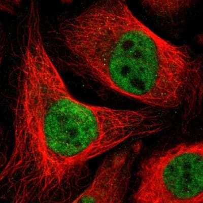 Immunocytochemistry/ Immunofluorescence: DLX5 Antibody [NBP1-85793]