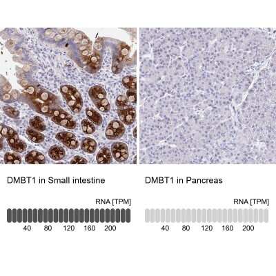 Immunohistochemistry-Paraffin: DMBT1/GP340 Antibody [NBP2-38471]