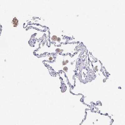 Immunohistochemistry-Paraffin: DMBT1/GP340 Antibody [NBP2-38471]