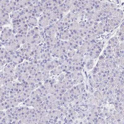 Immunohistochemistry-Paraffin: DMBT1/GP340 Antibody [NBP2-38471]