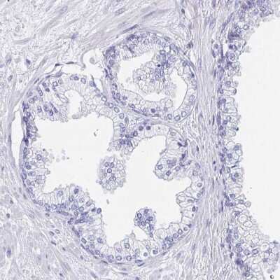 Immunohistochemistry-Paraffin: DMBT1/GP340 Antibody [NBP2-38471]