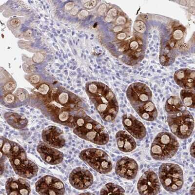 Immunohistochemistry-Paraffin: DMBT1/GP340 Antibody [NBP2-38471]