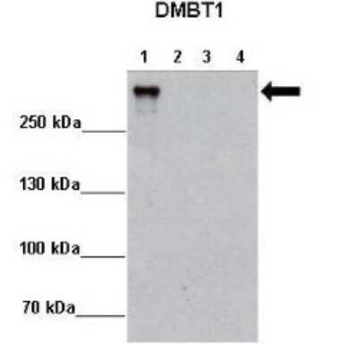 Western Blot: DMBT1/GP340 Antibody [NBP1-57668]