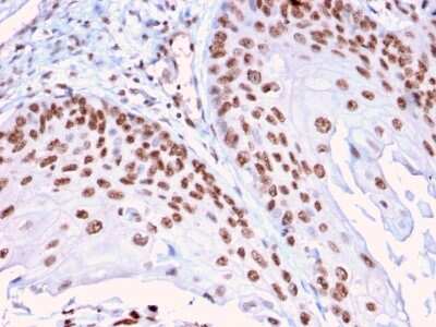 Immunohistochemistry-Paraffin: DMC1 Antibody (2H12/4) - Azide and BSA Free [NBP3-08832]