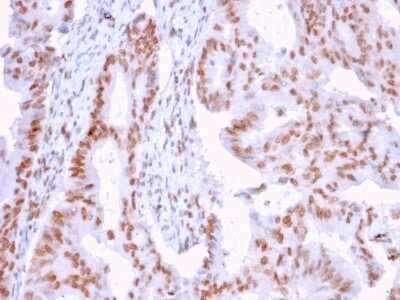 Immunohistochemistry-Paraffin: DMC1 Antibody (2H12/4) [NBP3-07507]