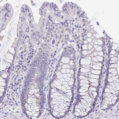 Immunohistochemistry-Paraffin: DMGDH Antibody [NBP1-86289]