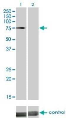 Western Blot: DMPK Antibody (2F7) [H00001760-M01]