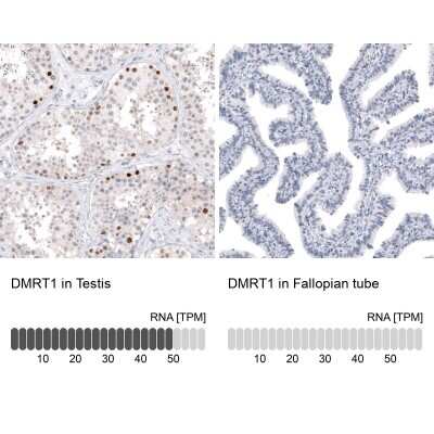 Immunohistochemistry-Paraffin: DMRT1 Antibody [NBP1-84071]