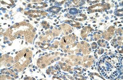 Immunohistochemistry: DMRT2 Antibody [NBP2-82871]