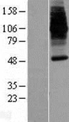 Western Blot: NRAMP2/SLC11A2/DMT1 Overexpression Lysate [NBP2-10692]