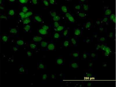 Immunocytochemistry/ Immunofluorescence: DMTF1 Antibody (5C6) [H00009988-M03]