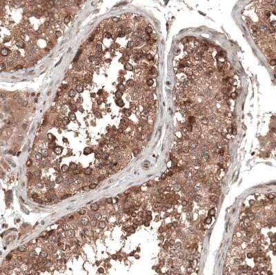 Immunohistochemistry-Paraffin: DMXL1 Antibody [NBP1-90998]