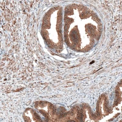 Immunohistochemistry-Paraffin: DMXL1 Antibody [NBP1-90998]