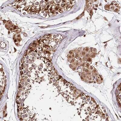 Immunohistochemistry-Paraffin: DMXL1 Antibody [NBP2-48656]