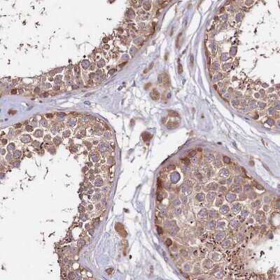 Immunohistochemistry-Paraffin: DMXL2 Antibody [NBP1-93618]