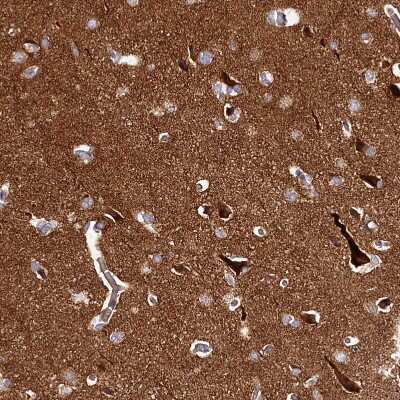 Immunohistochemistry-Paraffin: DMXL2 Antibody [NBP1-93618]