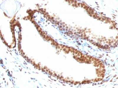 Immunohistochemistry-Paraffin: DNA Antibody (DSD/958) [NBP2-45219]