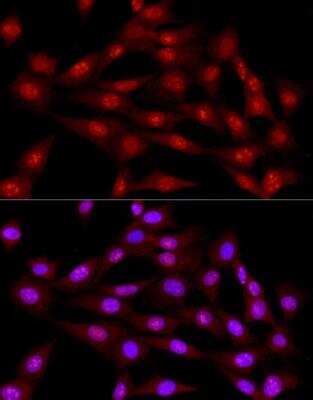 Immunocytochemistry/ Immunofluorescence: DNA Ligase III Antibody - Azide and BSA Free [NBP2-92719]