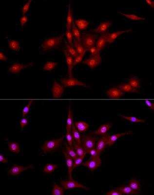 Immunocytochemistry/ Immunofluorescence: DNA Ligase III Antibody - Azide and BSA Free [NBP2-92719]
