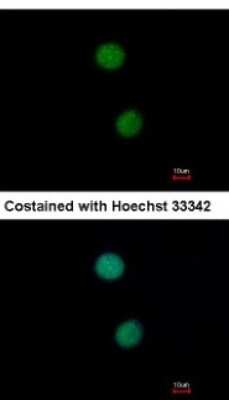Immunocytochemistry/ Immunofluorescence: DNA Ligase IV Antibody [NBP2-16182]