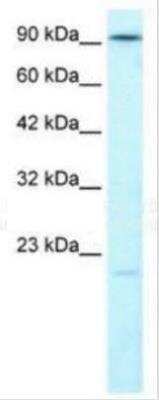 Western Blot: DNA Ligase IV Antibody [NB110-57379]