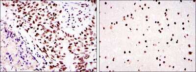 Immunohistochemistry-Paraffin: DNA-PKcs Antibody (3H6) - BSA Free [NBP2-22128]